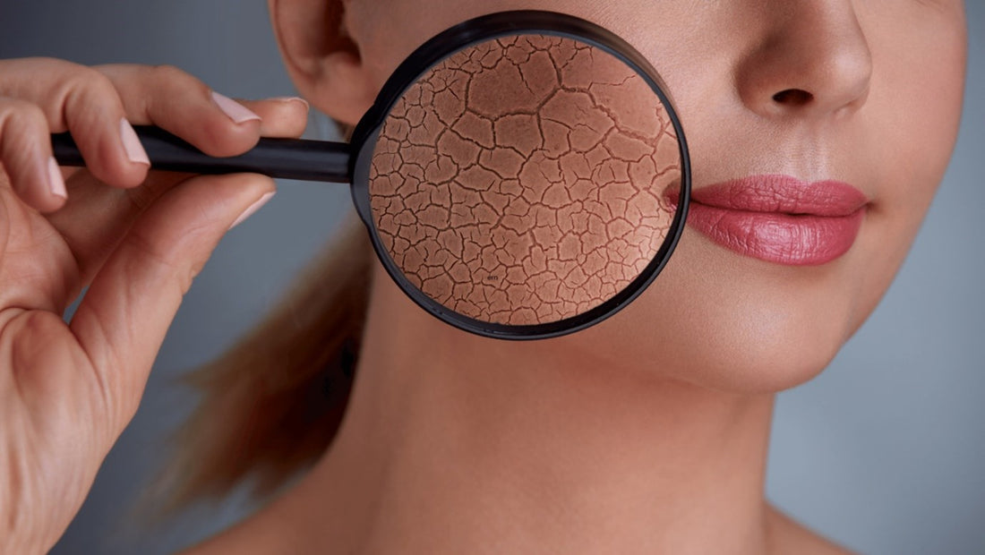 6 Different Skin Types and How to Identify Them